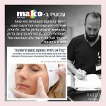 בגיל 34 ניסיתי בוטוקס בפעם הראשונה